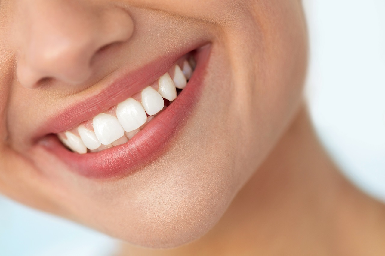 Wybielanie zębów – co powinieneś wiedzieć?